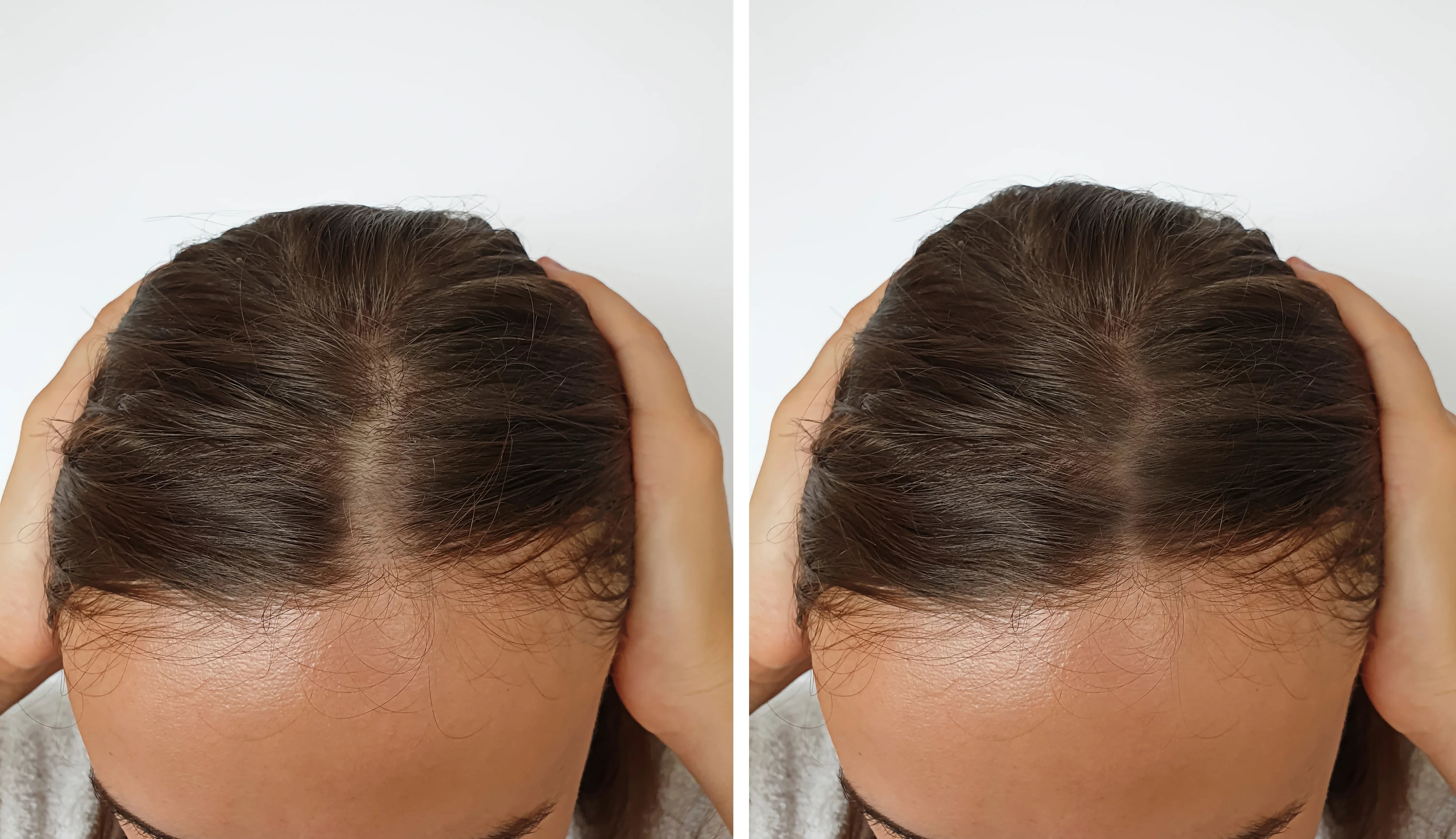 DENSIFICATION DES CHEVEUX ADISAEL POWER HAIR KERATIN